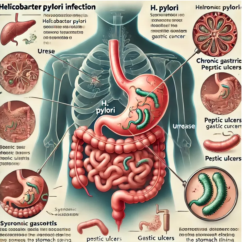 H. pylori tesztelés egyszerűvé tette: Az Ön megoldása a gyors és megbízható diagnózishoz