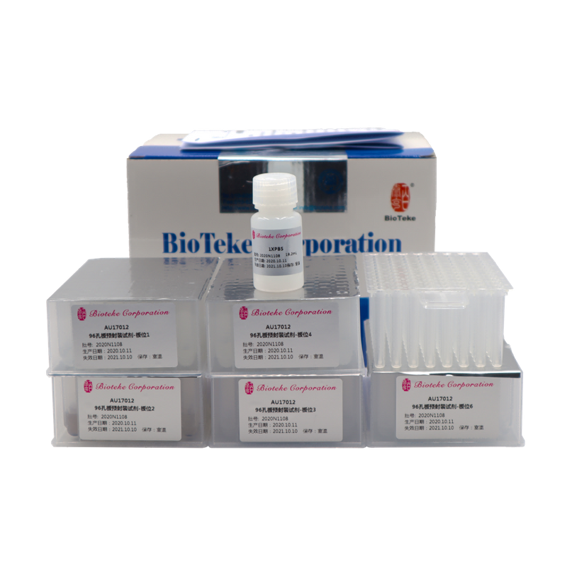 AU17011/17012 előrecsomagolt vírusos DNS RNS nukleinsav -extraháló készlet (mágneses gyöngyök)